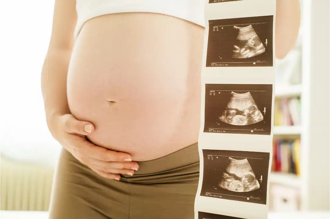 Pembagian Trimester Kehamilan Berdasarkan Minggu